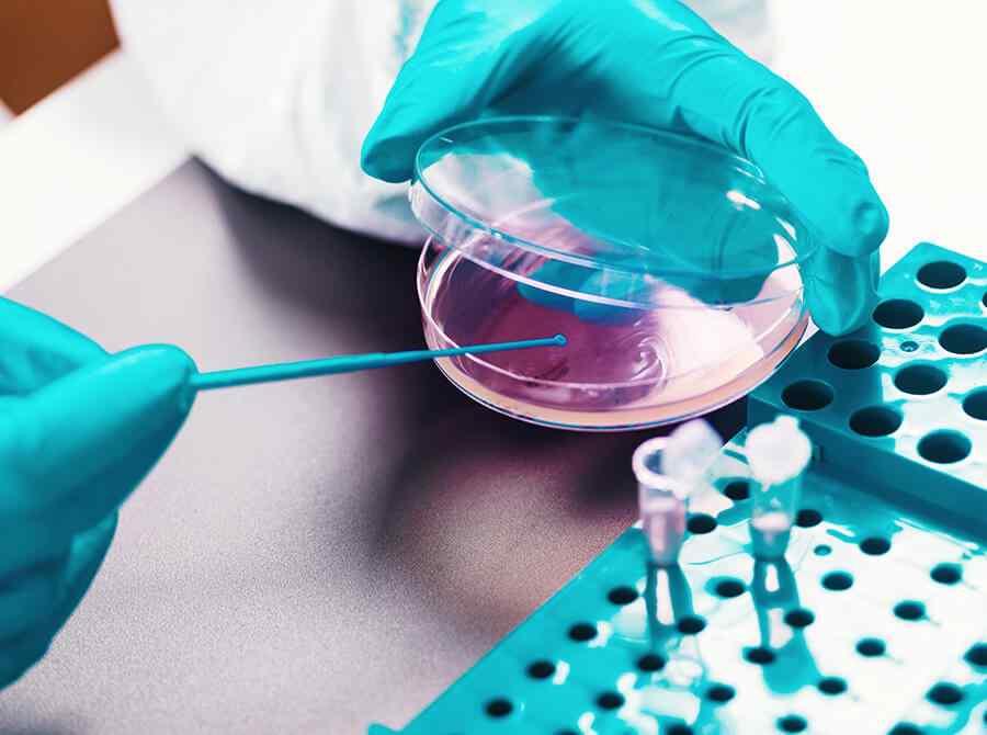 Microbiology tests Microbiology tests