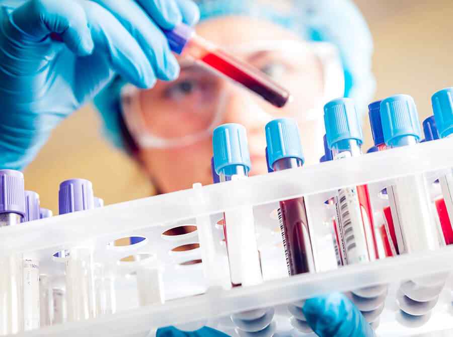 Histopatology tests Histopatology tests