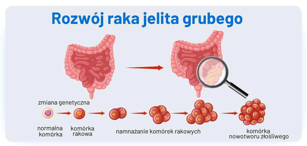 ColoAlert Nowy Nieinwazyjny Test Na Raka Jelita Grubego O Wysokiej 